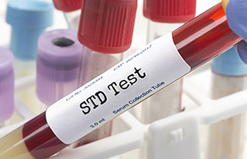 STD test investigation